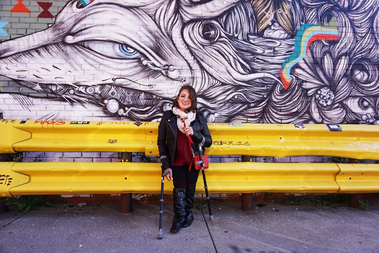 Melissa Divietri with Sacral Agenesis